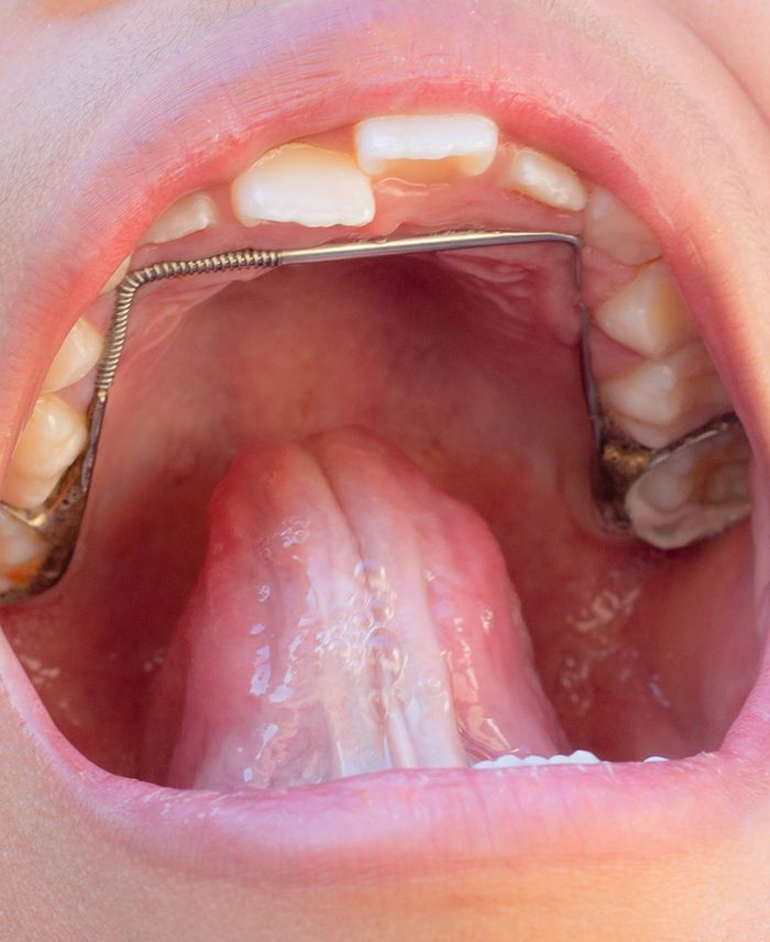 Fixed Space Maintainers