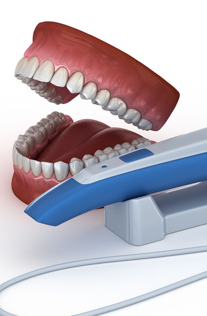 Intraoral Scanner