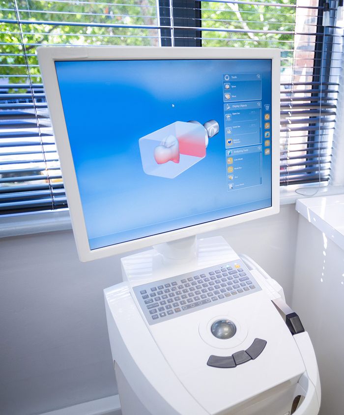 No More Messy Impressions